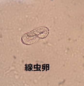 コツメカワウソの内部寄生虫